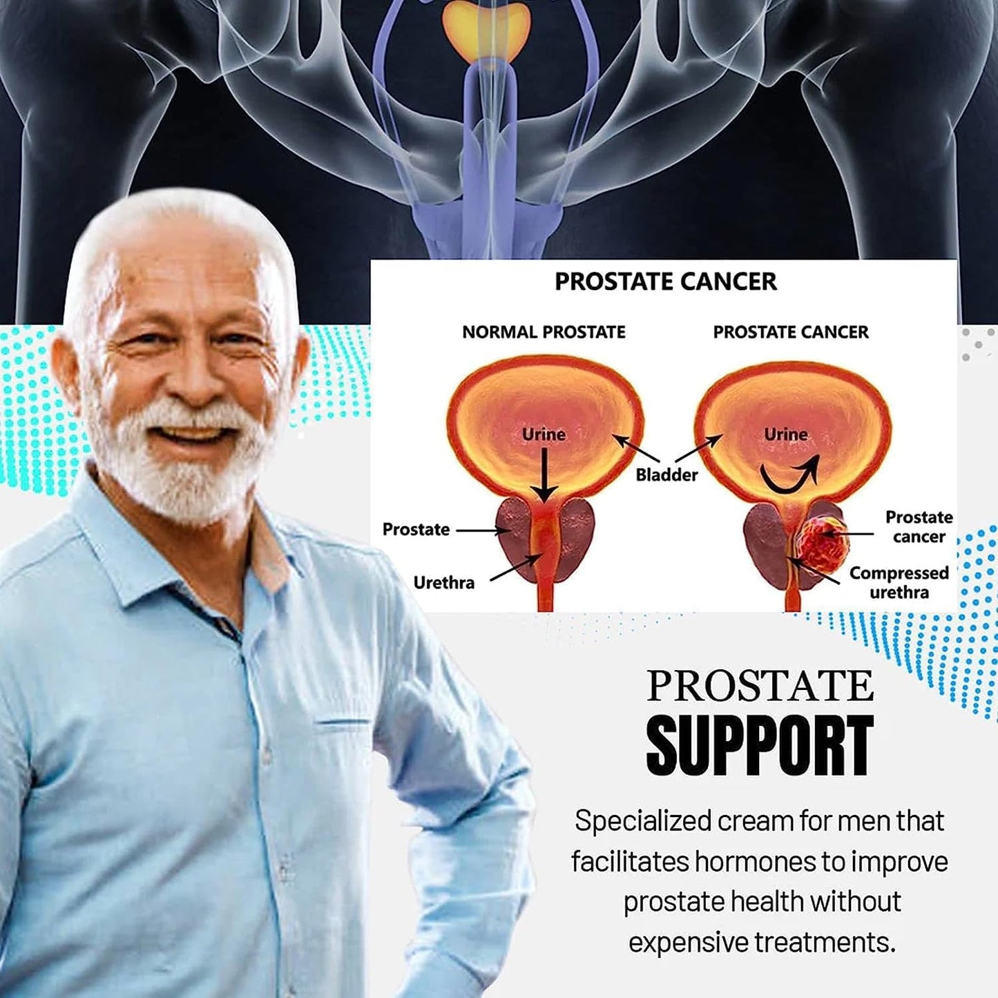 Pack (2 Boites ) Creame Pour Traitement De Prostate Chez Les Hommes